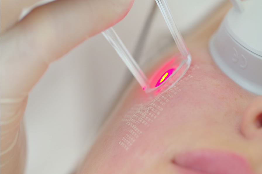 Laser Therapy with Suprana